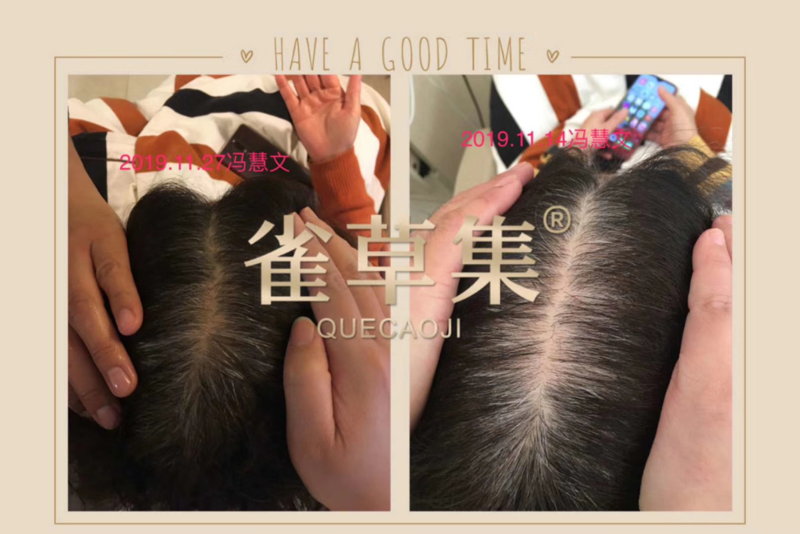 雀草集赋活健发精华素 赋活强韧洗发露生发效果展示